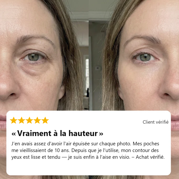 De vrais résultats chez de vraies femmes